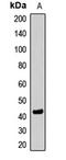 Lysine Methyltransferase 5A antibody, LS-C668813, Lifespan Biosciences, Western Blot image 
