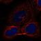 Zinc Finger DHHC-Type Containing 17 antibody, PA5-53492, Invitrogen Antibodies, Immunofluorescence image 