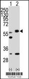 Serine/Threonine Kinase 11 antibody, TA300047, Origene, Western Blot image 