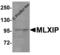 MLX Interacting Protein antibody, 8547, ProSci Inc, Western Blot image 