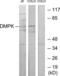DM1 Protein Kinase antibody, LS-C118996, Lifespan Biosciences, Western Blot image 