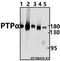 Protein Tyrosine Phosphatase Receptor Type A antibody, GTX66835, GeneTex, Western Blot image 