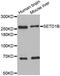 SET Domain Containing 1B, Histone Lysine Methyltransferase antibody, MBS126717, MyBioSource, Western Blot image 