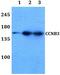 Cyclin B3 antibody, PA5-37254, Invitrogen Antibodies, Western Blot image 