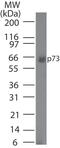 Tumor Protein P73 antibody, MA5-16168, Invitrogen Antibodies, Western Blot image 