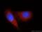 DEAD-Box Helicase 20 antibody, 11324-1-AP, Proteintech Group, Immunofluorescence image 