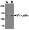 Vinculin antibody, TA326660, Origene, Western Blot image 