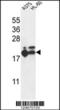 Ribosomal Protein L17 antibody, 64-172, ProSci, Western Blot image 