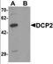 Decapping MRNA 2 antibody, orb137366, Biorbyt, Western Blot image 