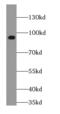Adducin 3 antibody, FNab03333, FineTest, Western Blot image 