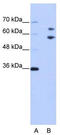 60 kDa SS-A/Ro ribonucleoprotein antibody, TA345889, Origene, Western Blot image 