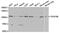 Platelet Derived Growth Factor Receptor Beta antibody, TA327319, Origene, Western Blot image 