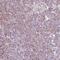 Ribosome Biogenesis Regulator 1 Homolog antibody, HPA060937, Atlas Antibodies, Immunohistochemistry frozen image 