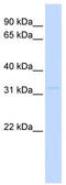 Phosphatidylinositol Transfer Protein Beta antibody, TA334456, Origene, Western Blot image 