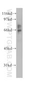 Crossover junction endonuclease EME1 antibody, 12975-1-AP, Proteintech Group, Western Blot image 