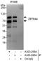 Zinc Finger And BTB Domain Containing 44 antibody, A303-260A, Bethyl Labs, Immunoprecipitation image 