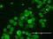 ERBB2 antibody, LS-C799213, Lifespan Biosciences, Immunofluorescence image 