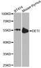 DET1 Partner Of COP1 E3 Ubiquitin Ligase antibody, A9974, ABclonal Technology, Western Blot image 
