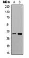 Ubiquitin Protein Ligase E3 Component N-Recognin 1 antibody, LS-C358878, Lifespan Biosciences, Western Blot image 