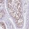 Cytochrome C Oxidase Copper Chaperone COX17 antibody, NBP2-30980, Novus Biologicals, Immunohistochemistry frozen image 