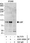 Autoantigen NOR-90 antibody, A301-859A, Bethyl Labs, Immunoprecipitation image 