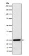 Hydroxysteroid 17-Beta Dehydrogenase 10 antibody, M03844, Boster Biological Technology, Western Blot image 