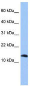 Peptidyl-TRNA Hydrolase 2 antibody, TA337573, Origene, Western Blot image 