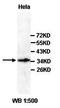 Adenylate Cyclase 10 antibody, orb77411, Biorbyt, Western Blot image 