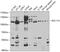 BAF Chromatin Remodeling Complex Subunit BCL11A antibody, GTX33126, GeneTex, Western Blot image 