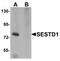 SEC14 And Spectrin Domain Containing 1 antibody, TA320072, Origene, Western Blot image 