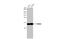 Neuraminidase antibody, GTX636967, GeneTex, Western Blot image 