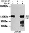 Kinesin-like protein KIF11 antibody, LS-B14243, Lifespan Biosciences, Immunoprecipitation image 