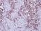 Muscle Associated Receptor Tyrosine Kinase antibody, GTX102521, GeneTex, Immunohistochemistry paraffin image 