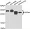 Glutathione S-transferase Mu 4 antibody, LS-C349137, Lifespan Biosciences, Western Blot image 
