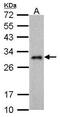 Protein lin-28 homolog A antibody, GTX628139, GeneTex, Western Blot image 