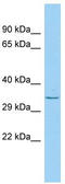 Inactive phospholipase D5 antibody, TA332152, Origene, Western Blot image 