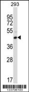 Fc Fragment Of IgG Receptor IIc (Gene/Pseudogene) antibody, 57-229, ProSci, Western Blot image 