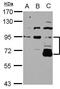 DIS3 Like 3'-5' Exoribonuclease 2 antibody, PA5-31273, Invitrogen Antibodies, Western Blot image 