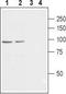 Voltage-dependent L-type calcium channel subunit beta-2 antibody, TA328763, Origene, Western Blot image 