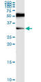 Recombination Activating 2 antibody, LS-C198057, Lifespan Biosciences, Western Blot image 