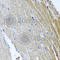 Gasdermin E antibody, A7432, ABclonal Technology, Immunohistochemistry paraffin image 