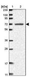 Leucine Rich Repeat Containing 40 antibody, NBP1-82185, Novus Biologicals, Western Blot image 