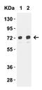 Translocase Of Outer Mitochondrial Membrane 70 antibody, A09172, Boster Biological Technology, Western Blot image 