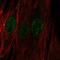 Chromosome 22 Open Reading Frame 23 antibody, HPA000650, Atlas Antibodies, Immunofluorescence image 