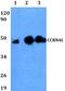 Nocturnin antibody, PA5-75766, Invitrogen Antibodies, Western Blot image 