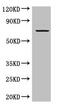 GRAM Domain Containing 4 antibody, CSB-PA764225LA01HU, Cusabio, Western Blot image 