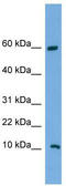 Chromosome 20 Open Reading Frame 144 antibody, TA340251, Origene, Western Blot image 