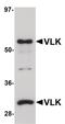 Protein kinase domain-containing protein, cytoplasmic antibody, PA5-20875, Invitrogen Antibodies, Western Blot image 