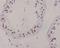 DNA repair protein XRCC1 antibody, M00571, Boster Biological Technology, Immunohistochemistry paraffin image 