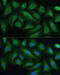 Protein Tyrosine Phosphatase Non-Receptor Type 22 antibody, 15-350, ProSci, Immunofluorescence image 